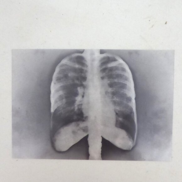 6” x 4” 24 HALLOWEEN ACETATE PLASTIC PAPER X-RAY IMAGE PAD - Picture 10 of 10